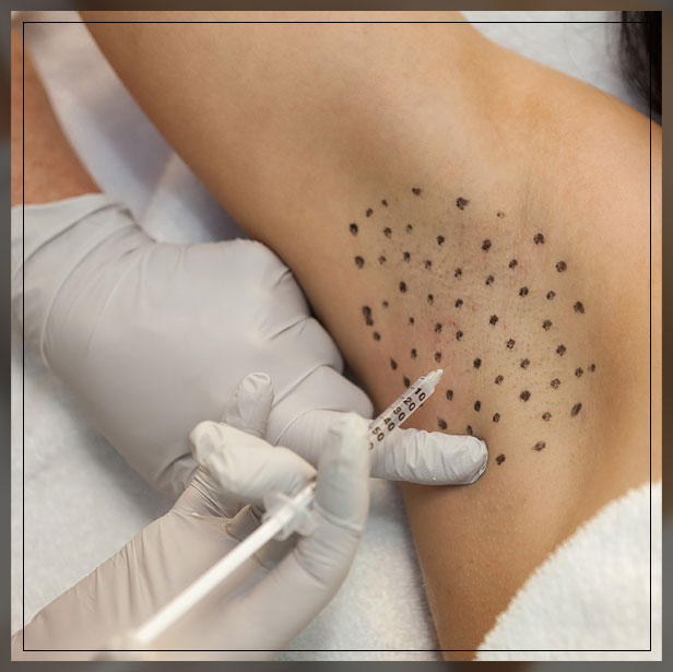 underarm botox procedure